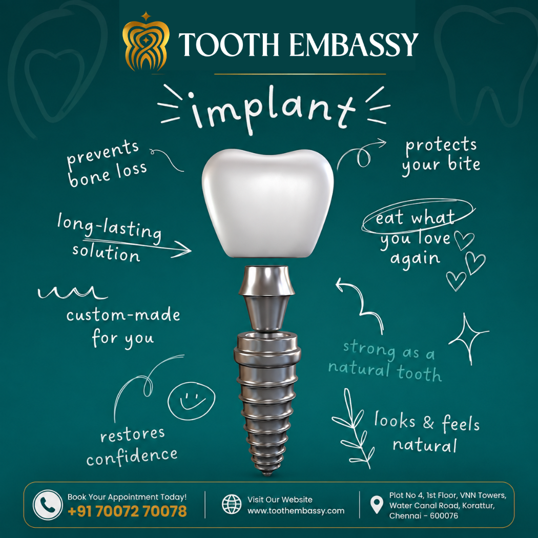 Dental Implant Clinic In Korattur